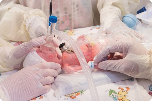 Premature Anne general teaching Laerdal