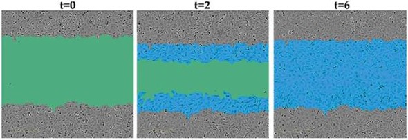 Quantifying Cell Migration and Invasion