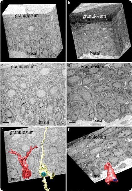 Shows the epidermis layer of patients with melisma
