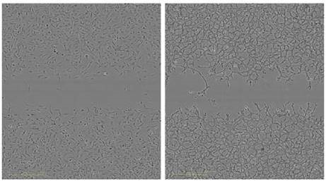 Measurement of the reproducibility the migration and Invasion Assay in the same microplate