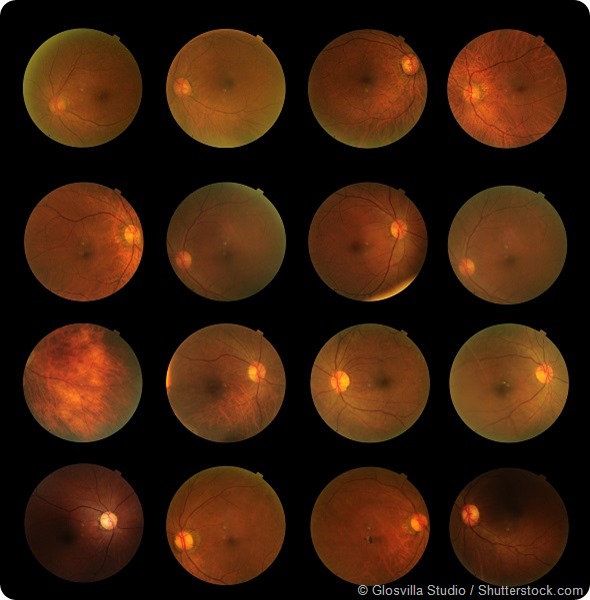 human eye disorders retina, optic nerve and macula