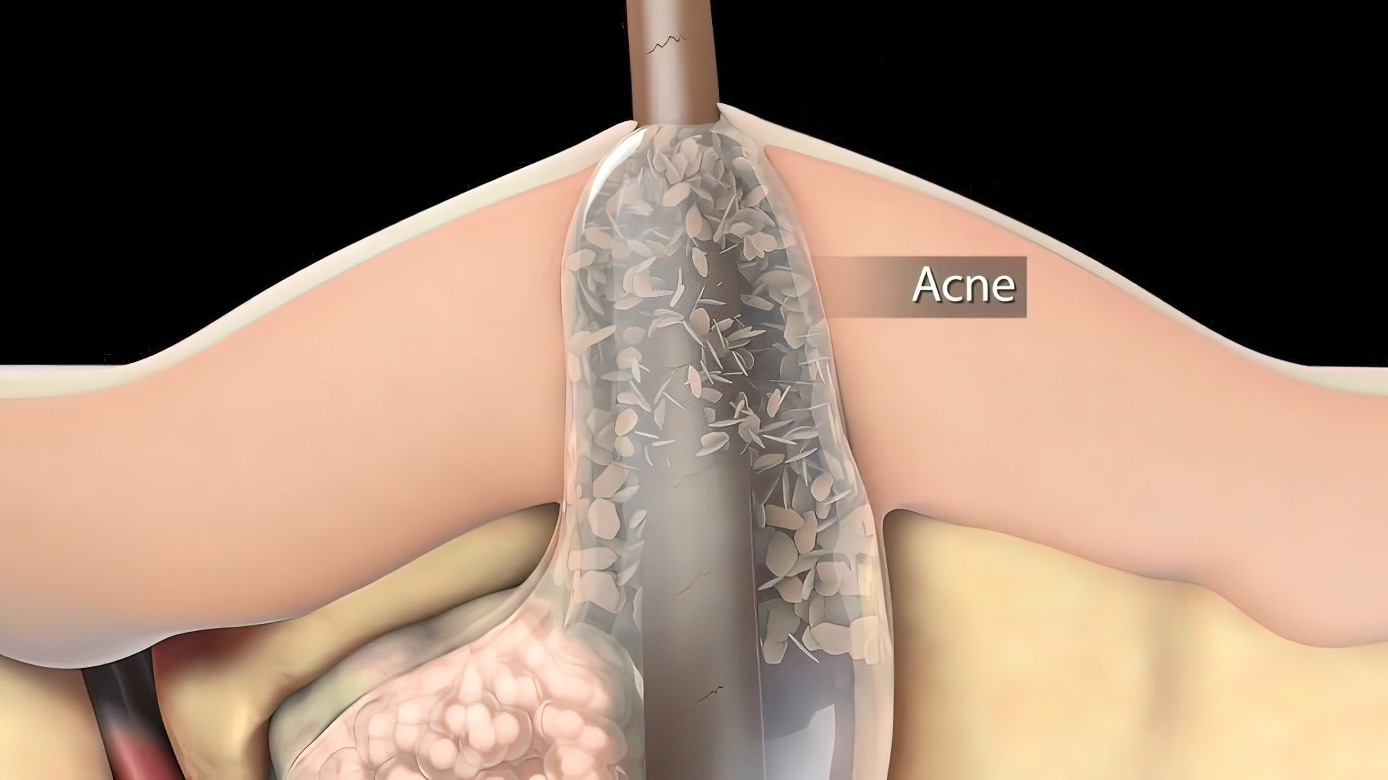 Image Credit: picmedical/Shutterstock