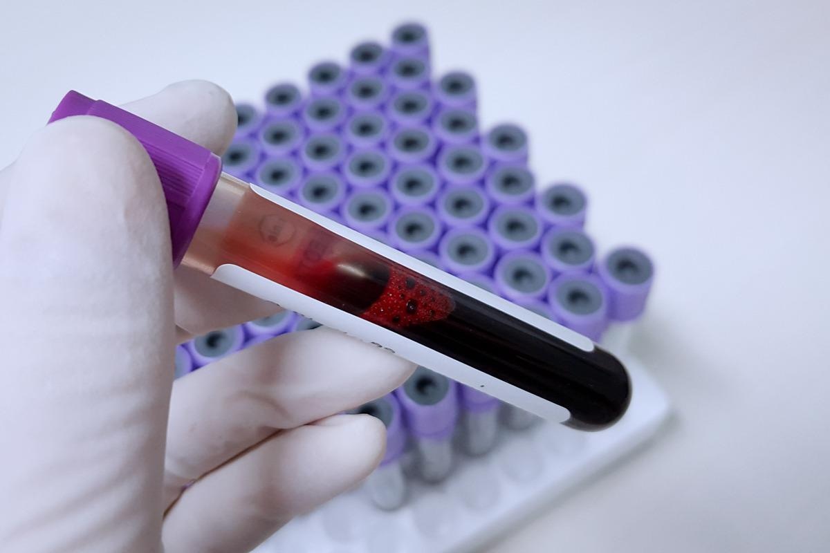 Image Credit:  Anyanee anun/Shutterstock