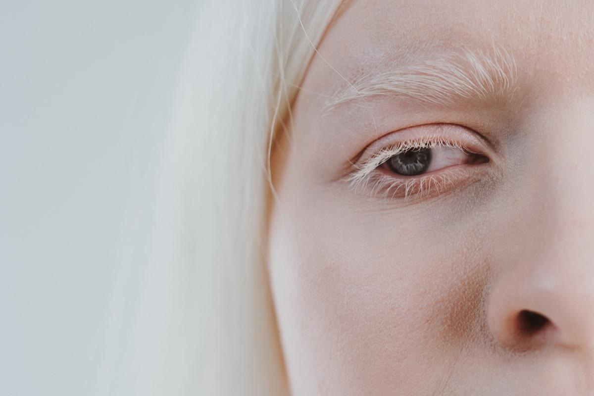 Image Credit: oneinchpunch/Shutterstock