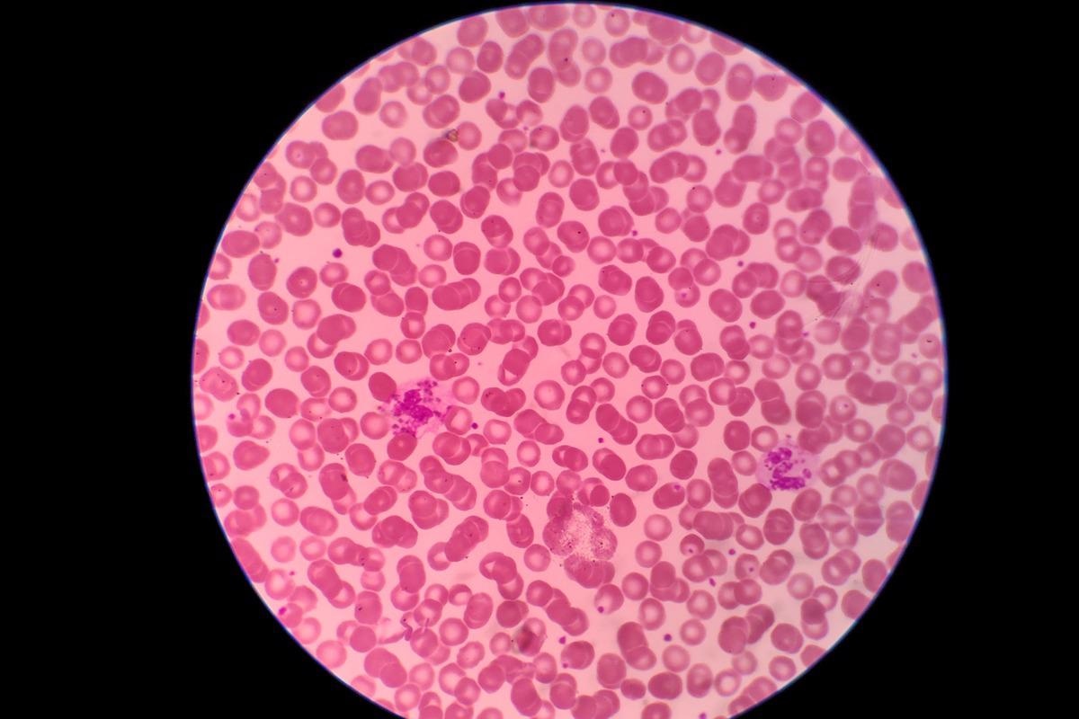 Image Credit: Frawash/Shutterstock