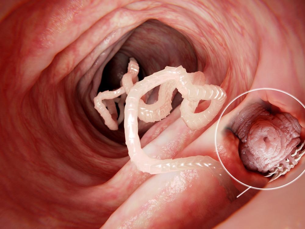 Intestinal Parasite