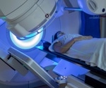 The Cognitive Side Effects of Radiation Treatment
