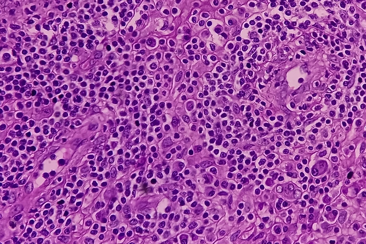 Image Credit: Babul Hosen/Shutterstock