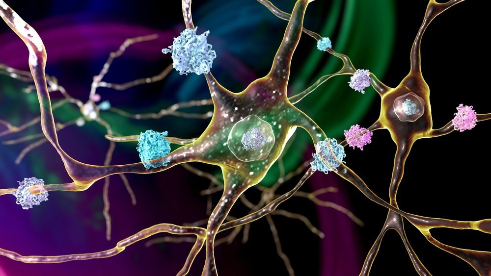 Image Credit: Kateryna Kon/Shutterstock.com