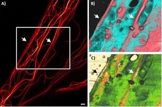 AFM in living cell experiments