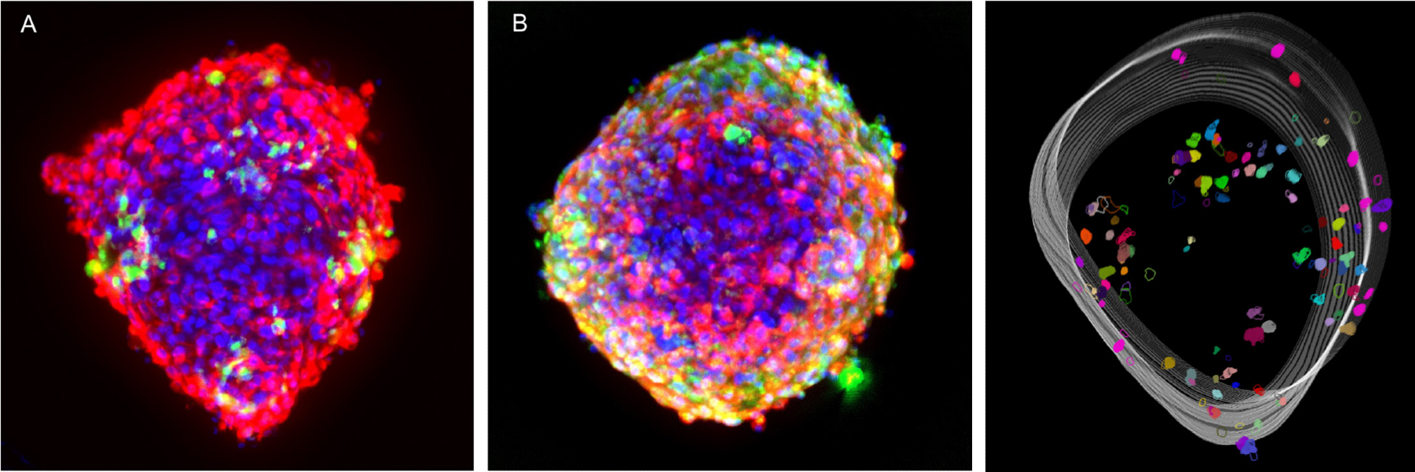 How does the FLIPR Penta System Allow for Better Resolution Calcium Oscillation Patterns in Cardiomyocytes?