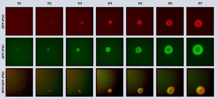 How to accelerate the use of iPSCs in drug development