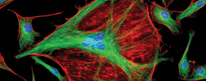 Cell culture monitoring: exploring permittivity measurements versus viable cell counts
