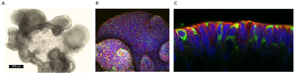 Human Descending Colon Organoids Grown in Cultrex UltiMatrix RGF Basement Membrane Extract.