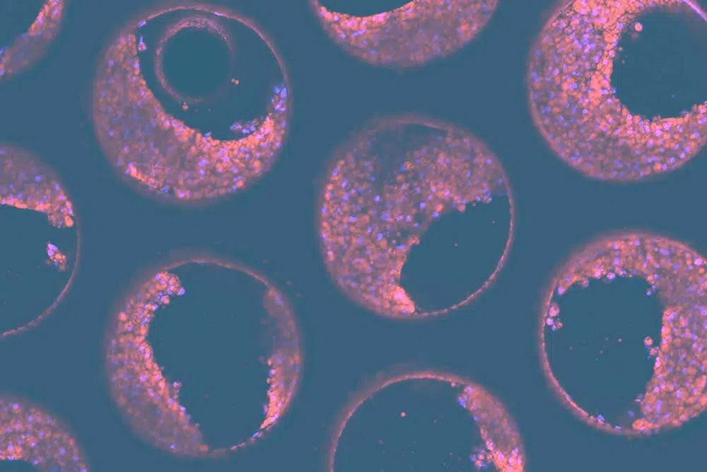Decoding Organ-on-a-chip (OOC) success: Navigating the critical cell selection phase