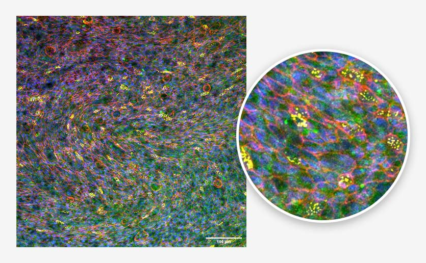 Bronchial epithelium. Tissue generated using the CN Bio PhysioMimix® OOC and Barrier (MPS-T12) Plates. Ciliated cells (yellow), mucus (green), actin cytoskeleton (red), and nuclei (blue) are indicated.