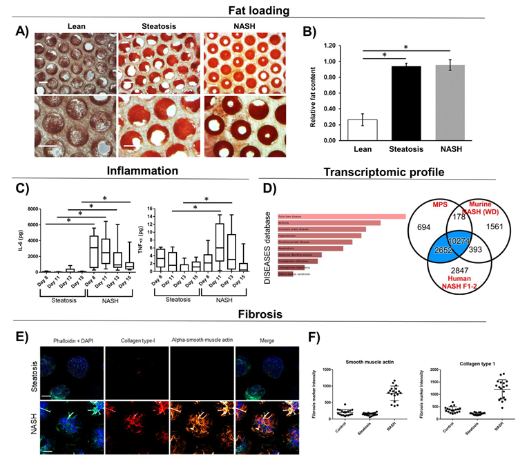 Liver MPS microtissues loaded with fat display NASH phenotype. PHH, HK and HSC were culture in the liver MPS in either lean or fat conditions. Steatosis controls contained 10-fold less HK and HSC than NASH co-cultures. Microtissues analyzed for A + B) Fat loading via quantified Oil Red O staining. C) Inflammatory biomarkers were measured in cell culture medium; D) Transcriptomic profile of NASH microtissues was analyzed via DISEASEs database and compared to profile of human NASH biopsy samples and western diet ( NASH mice - numbers highlight number of overlapping DEGs. E) Fibrosis was measured and quantified using high content confocal microscopy. Microtissues were imaged (representative images shown) and F) images quantified. All scale bars 300 µm. Data are mean ± SD, n = minimum 6. * = P < 0.05. 