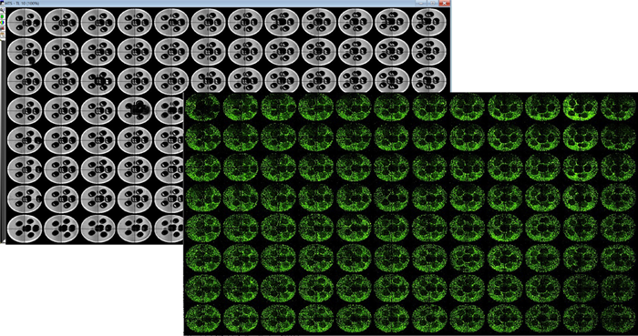 TL image of 3D printed pluronic pillar arrays captured using ImageXpress Micro Confocal system (4X) (left–grey panel). Plate representations of uniformly seeded HepG2 cells in collagen I after pluronic pillars were washed (right – green panel). The holes in the dense collagen matrix enabled for better exchange of nutrients and gases. This eventually prevents the cells in the center of the matrix from undergoing necrosis.