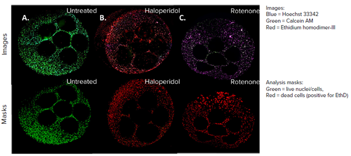 HepG2 cell model confocal images, 4X all sites image (top panel), and their representative live dead analysis masks generated by MetaXpress software (bottom panel). A) Untreated control, B) Haloperidol (100 µM), C) Rotenone (100 µM).