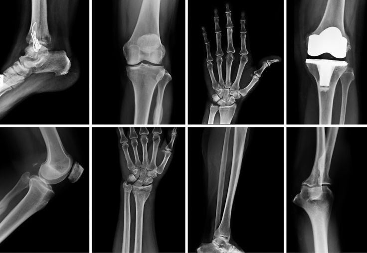 Detection of cancer and infections using Raman for point-of-care