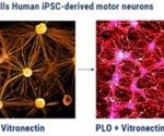 iPSC-Based Neuromuscular and Neuronal Models for ALS and Drug Discovery