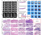 BMP-2 loaded scaffold for stem and immune cell recruitment in therapeutic applications
