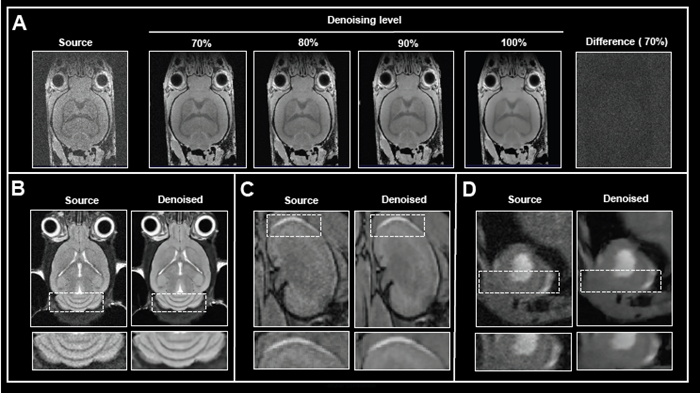 The effect of image denoising on image quality.