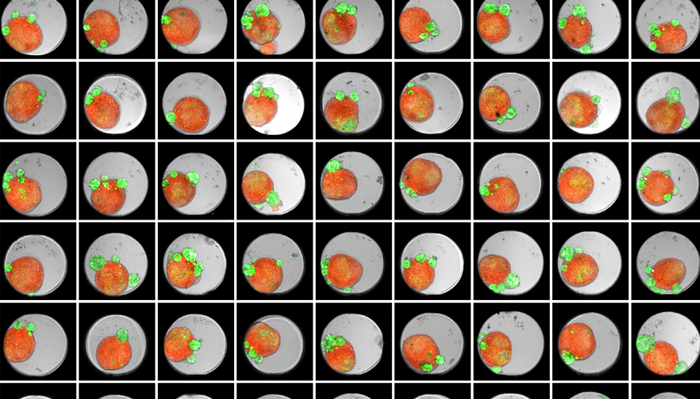 Thumbnail of an Akura 384™ well plate of 3D tumor co-culture microtissues - NCI-N87-GFP (green), NIH-RFP (red), Bright Field (gray)