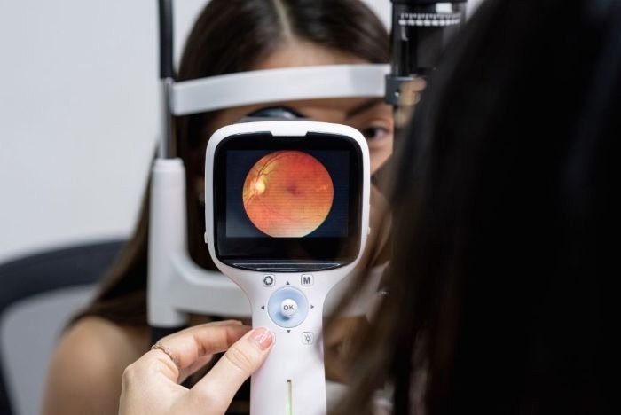 A sample image of a handheld wide-angle fundus camera