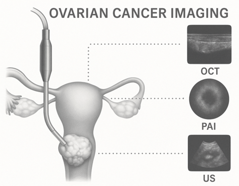 Breakthrough imaging for early ovarian cancer detection with GaGe digitizers