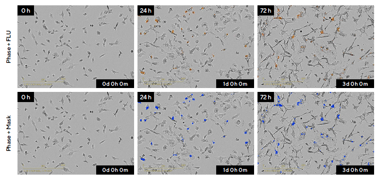 Visualization and Quantification of HT-1080 Fibrosarcoma Cells in Response to the Anti-Cancer Drug Cisplatin (CIS) in Real-Time.