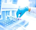 Improving sample preparation for LC-MS/MS analysis