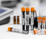Are your vial labeling methods sabotaging your lab’s productivity?