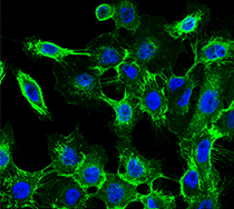 ADC target antigens in solid tumors