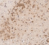 Induced pluripotent stem cell (iPSC) cytokines