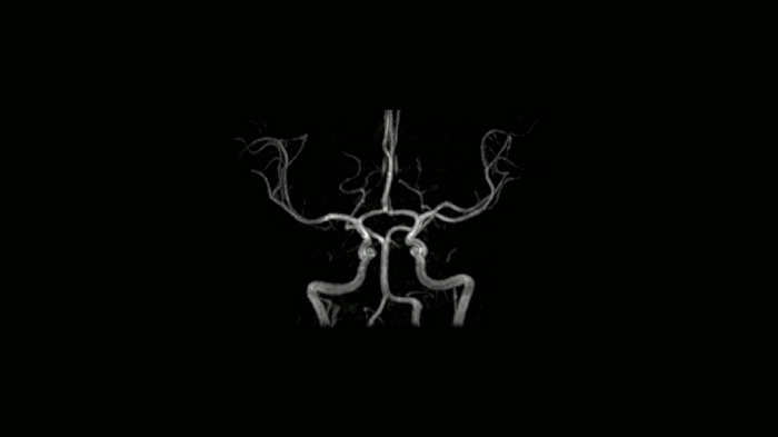 80 cm bore MAGNETOM Free.Max