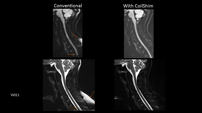 3T MRI scanner MAGNETOM Vida