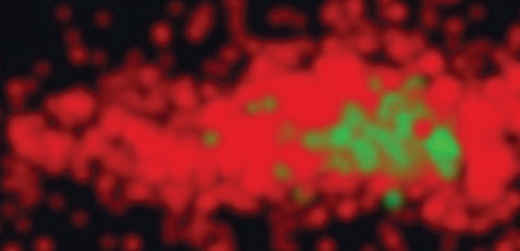 Vutara VXL-Super-resolution microscopy workstation