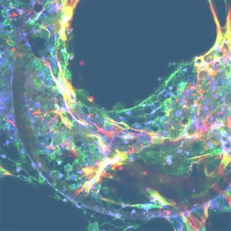 NAFLD/NASH in vitro services for fast-tracked OOC studies