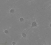 axoCells™ : Functional human iPSC-derived Motor Neurons for drug discovery and research