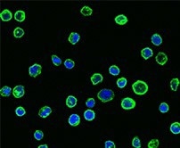 Immunofluorescence staining of CD58 in Raji cells.