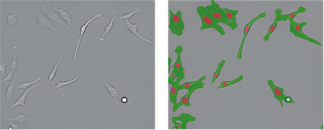 Left: CE Bright Field. Right: Cell Recognition image