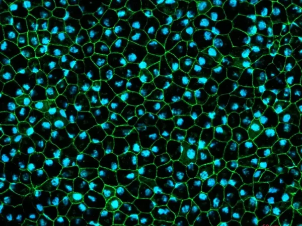 RPE cells displaying cobblestone morphology. Cells were immunolabeled with tight-junction ZO-1 marker (shown in green) and co-stained with nuclei marker, Hoechst (shown in blue)