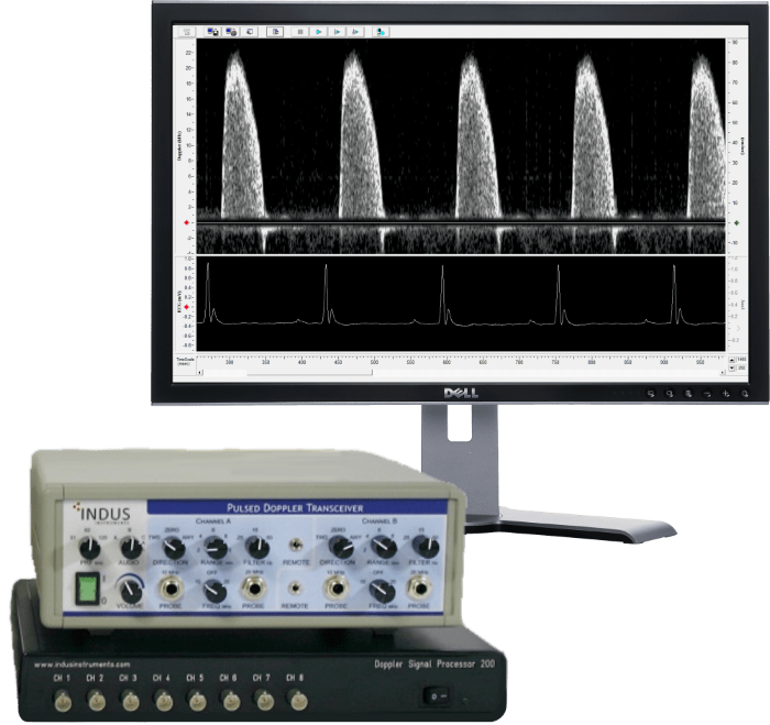 Non-invasive Doppler Flow Velocity System