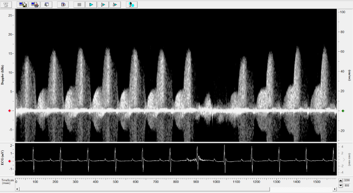 Mouse - Left Anterior Descending Coronary Artery