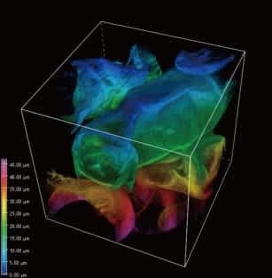 Live cell imaging with the CSU-W1 SoRa confocal scanner