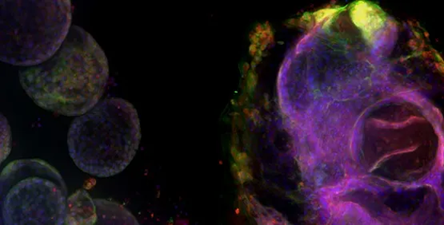 3D Organoid Expansion Service