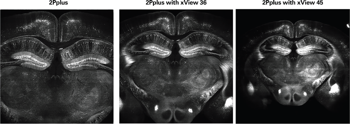 Mouse brain imaged with Ultima 2Pplus and a 4× 0.28 NA Olympus objective using xView 36 and xView 45 lenses, revealing a larger FOV without loss of resolution