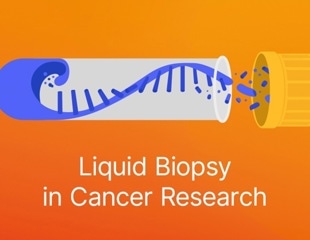 eBook: Liquid biopsy in cancer research