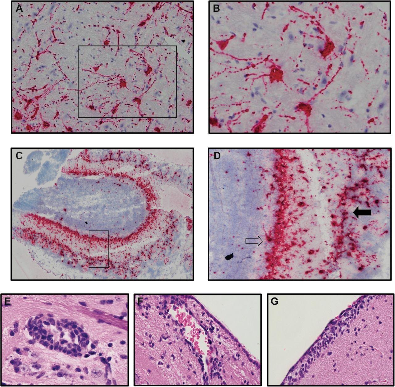 Neurons are targets of infection within the brains of SARS-CoV-2 infected K18-hACE2 mice. Brains of SARS-CoV-2 infected mice at day 7 p.i. were analyzed to assess cellular targets of infection through in situ hybridization using RNAscope in situ hybridization using Spike-specific probes. (A) Cells within the cortex with neuron morphology were primary targets of infection; (B) high-power image of cells boxed in panel A show viral RNA present within cell body as well as extending down dendrites extending from the cell body. (C) Viral RNA was also detected in olfactory bulbs at day 7 p.i. (D) high-power image cells boxed in panel C reveal neurons in the mitral (open arrow) and glomerular (closed arrow) are infected by virus. Representative H&E images from the brains of infected K18-hACE2 mice at day 7 p.i. depicting (E) perivascular cuffing, (F) subventricular inflammation, and (G) leptomeningitis.